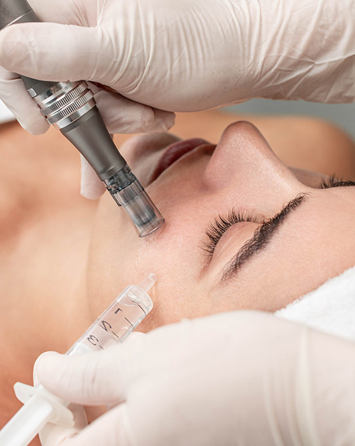 Microneedling tretman s DR.PEN uređajem za regeneraciju kože